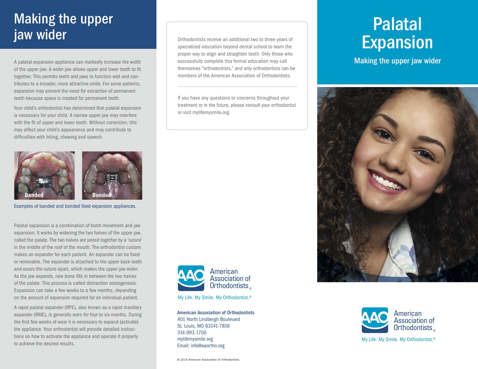 palatal-expansion